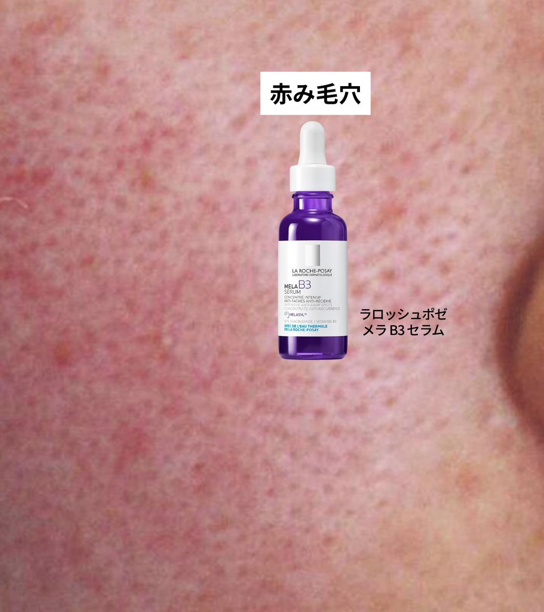 Yuiの美容帳✎𓂃𓈒𓏸 tweet media