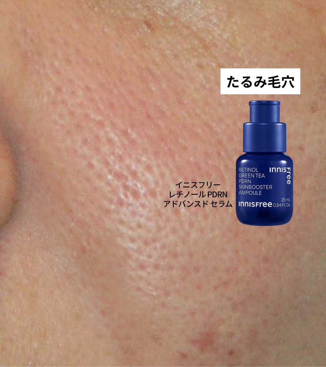 Yuiの美容帳✎𓂃𓈒𓏸 tweet media