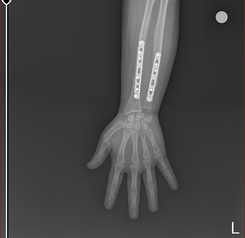 KILINC #okanburukistifa tweet media