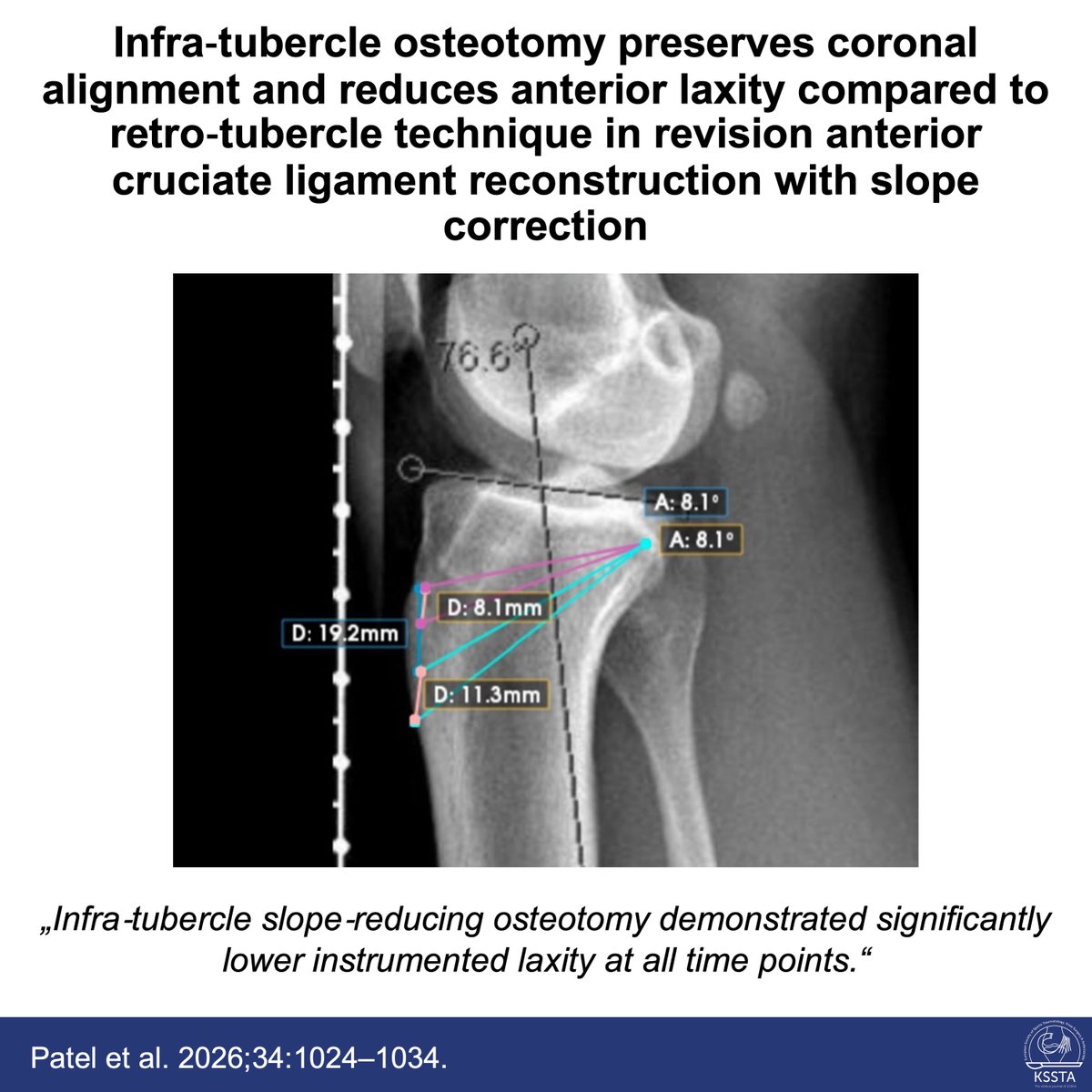 Knee Surgery, Sports Traumatology, Arthroscopy tweet media
