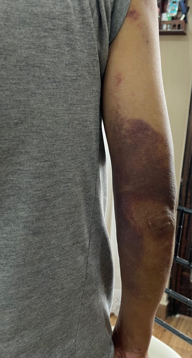 Acess Ecuador 🇪🇨 tweet media