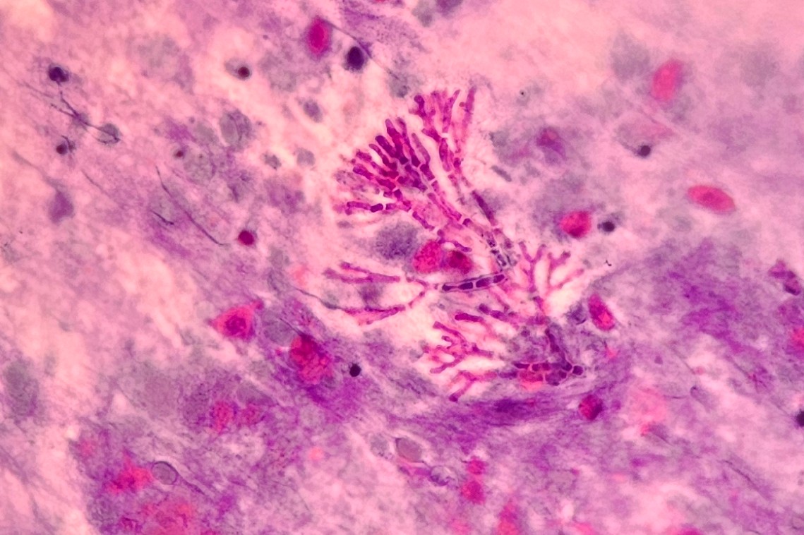 Anupama Arya tweet media