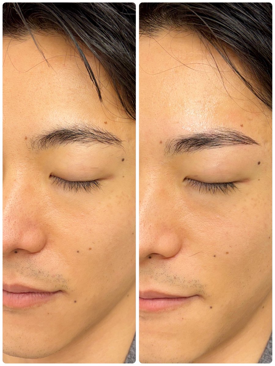 3/20㊗️20時、21時
3/22(日)14時半〜22時
ご予約◎

JR渋谷駅（ハチ公口）徒歩10分
宇田川町　東急ハンズ
OPEN11:00 〜CLOSE22:00

#笹塚眉毛サロン #世田谷眉毛サロン #用賀眉毛サロン #渋谷メンズ眉毛 #メンズ眉毛サロン東京 

𓃟

ラディーグホットペッパー

beauty.hotpepper.jp/kr/slnH0005906…