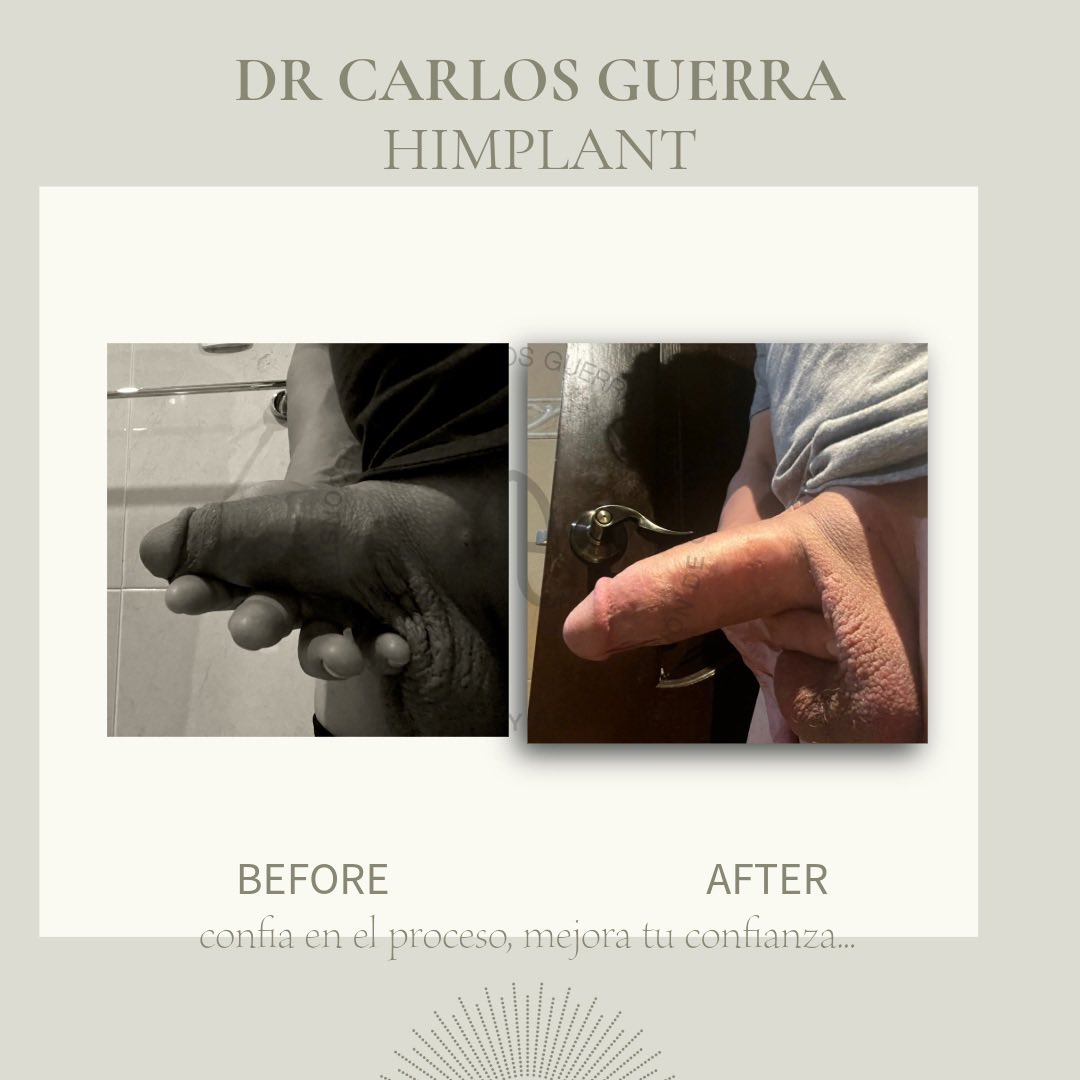 Urologo Dr. Carlos Guerra tweet media