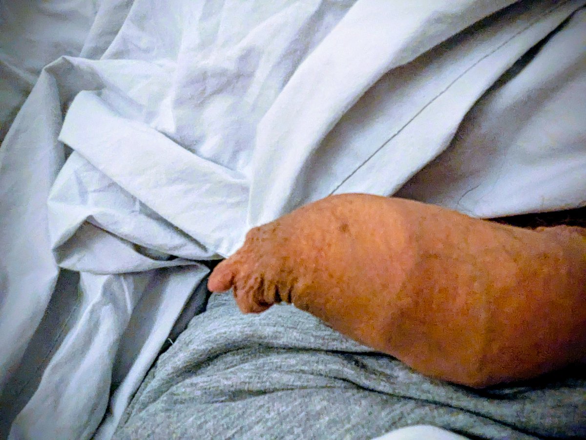 Meatoflow 🇨🇵 🏳️‍🌈 tweet media