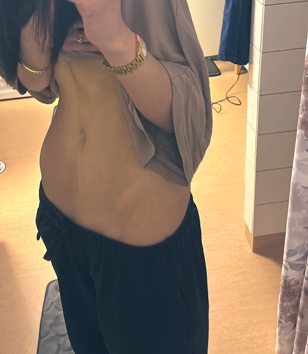 aurorialll's tweet photo. hip bones are beautiful
#edtwt #bodycheck https://t.co/LrAr0xKJha