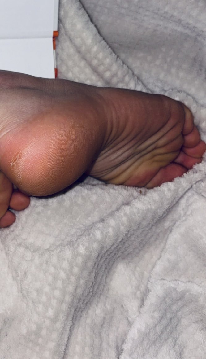 ๐
๐๐พ๐๐๐๐ถ๐๐ถ ๐ธ tweet media