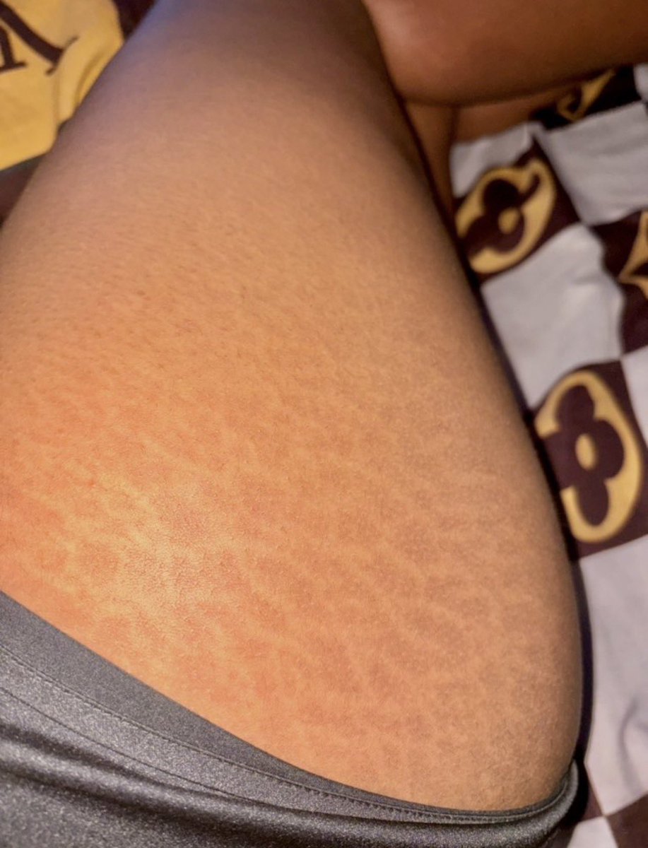 MissHelen🌹 tweet media