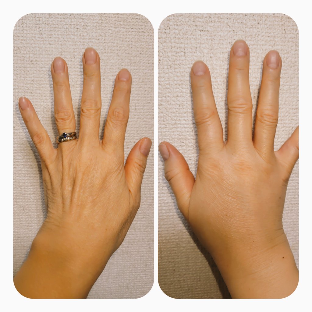 まみ@リウマチとともに tweet media