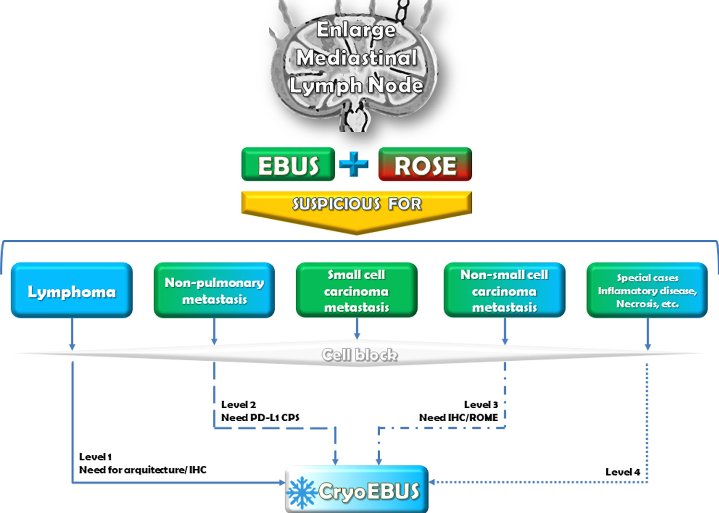 🫁 Enlarged mediastinal lymph node.
❄️ CryoEBUS.
🔬 Non Necrotizing granulomatous lymphadenitis.
4️⃣ Level CryoEBUS indication.
🔗 pubmed.ncbi.nlm.nih.gov/39837131/