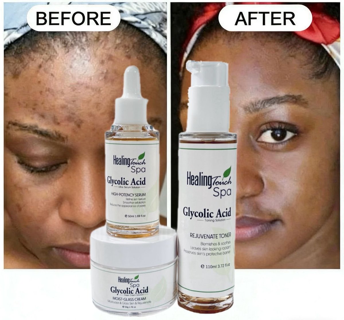 Reveal brighter, smoother skin with our Glycolic Acid range 💧

✔ Gently exfoliates dead skin
✔ Improves skin texture &amp; tone
✔ Brightens dull skin
✔ Fades dark spots &amp; marks
✔ Promotes a radiant, healthy glow