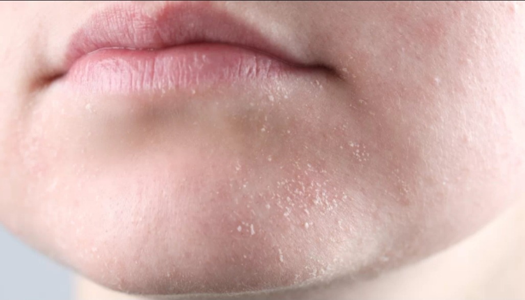 ✨OMBB | 🚫NO LINK tweet media