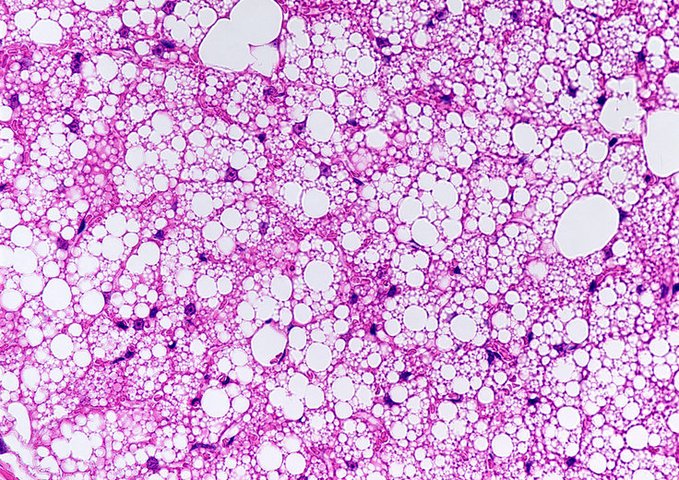 EARA France tweet media