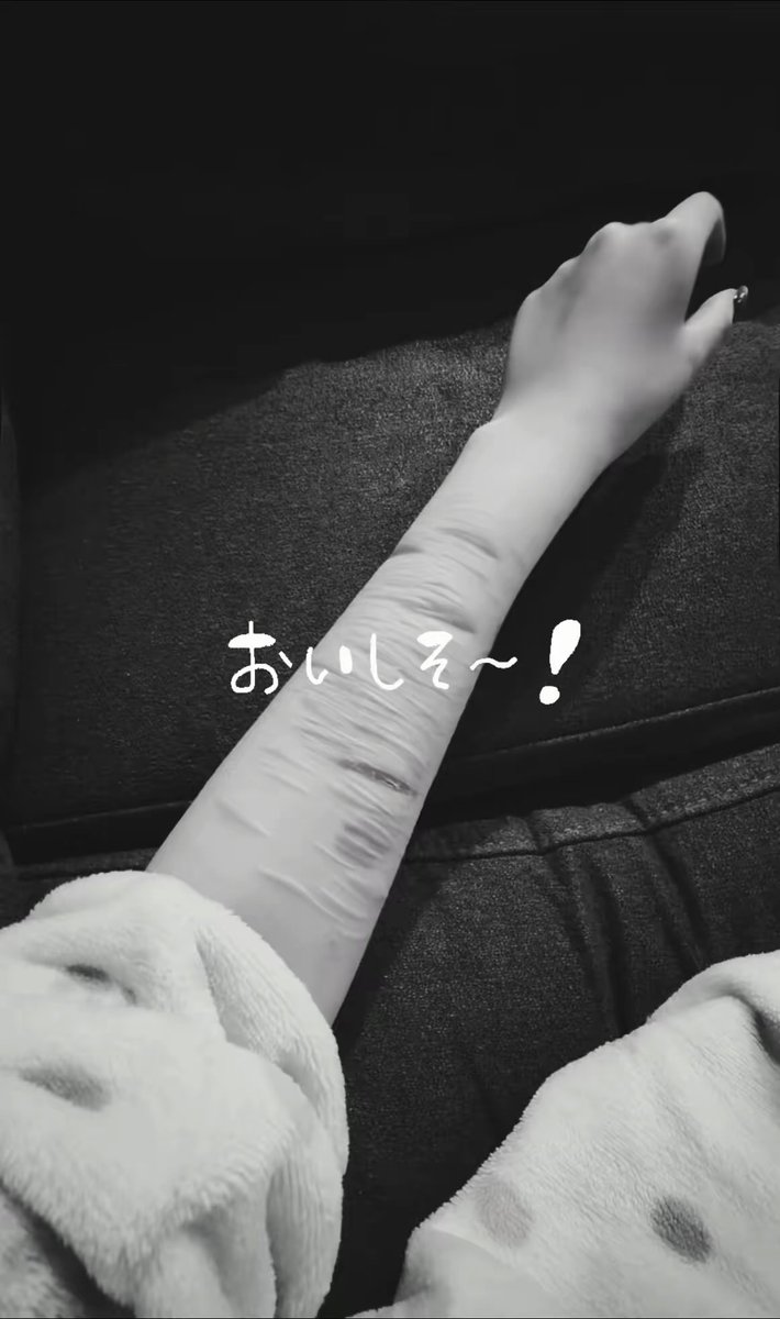 teyu_s2's tweet photo. ぽいぽい

#自傷垢 #自傷行為 #自殘 #自残 https://t.co/t8eGMpBwZh