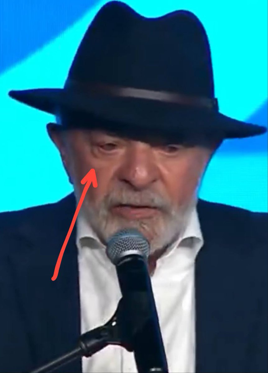 Veja o vídeo do Lula com chapéu preto misterioso e preste atenção principalmente no olho.