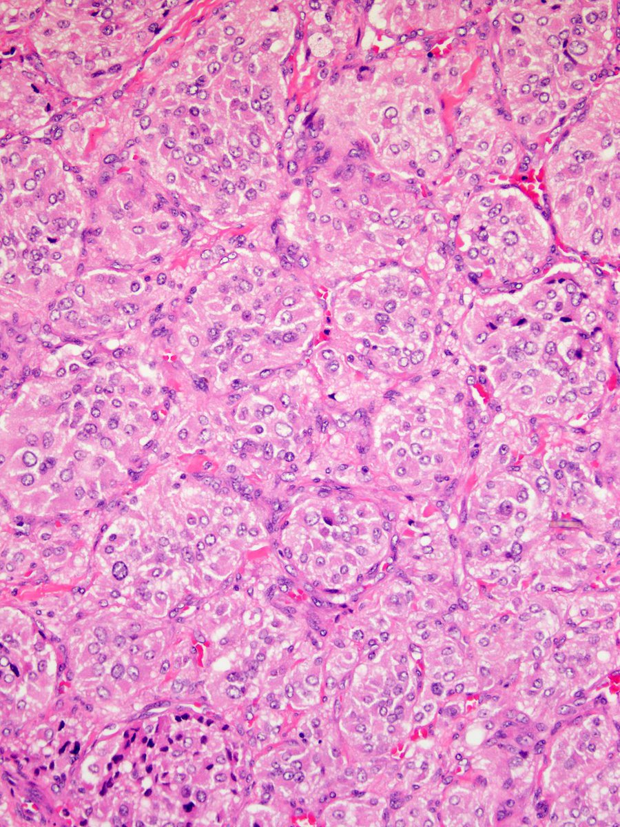 Charlie Herndon tweet media