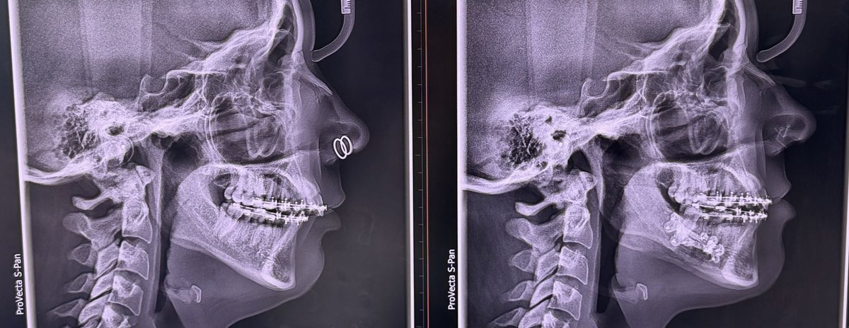 BailiBytes tweet media