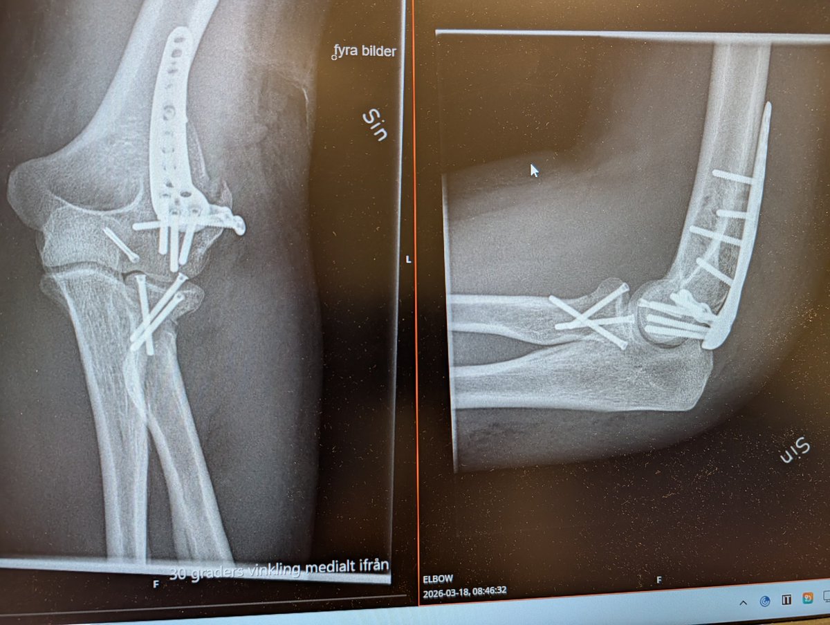 Erik 🏴 | 🧬😷👨‍🔬 tweet media