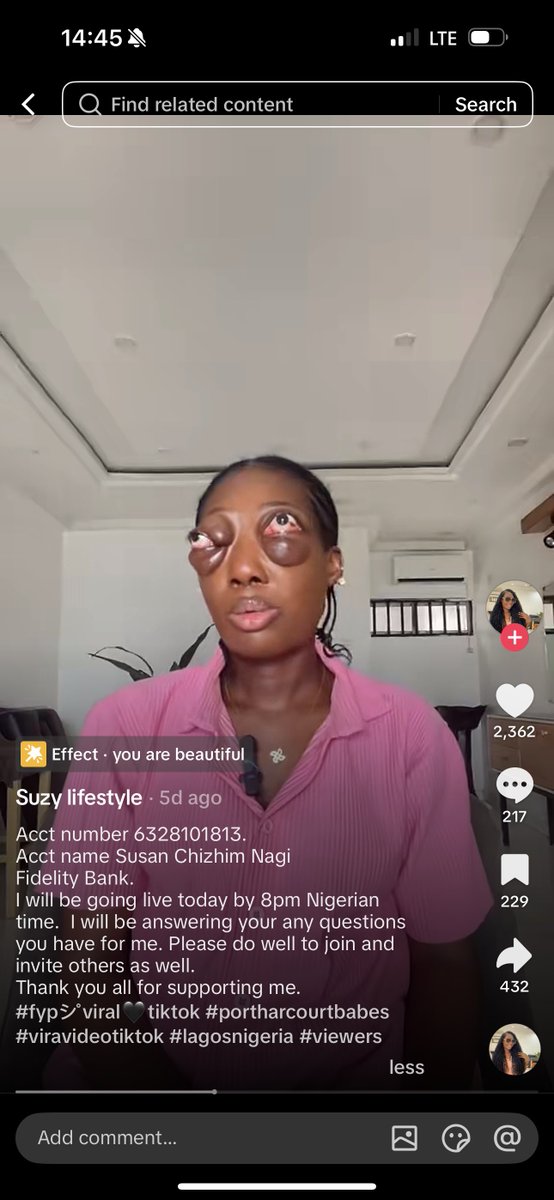 Alayo💖 ✨ tweet media