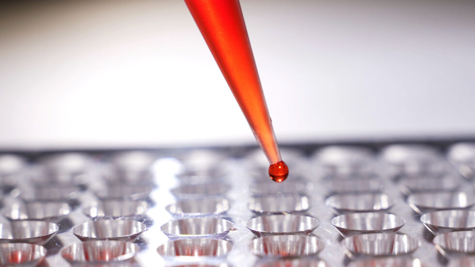 Fed. Nac. ALCER oficial tweet media