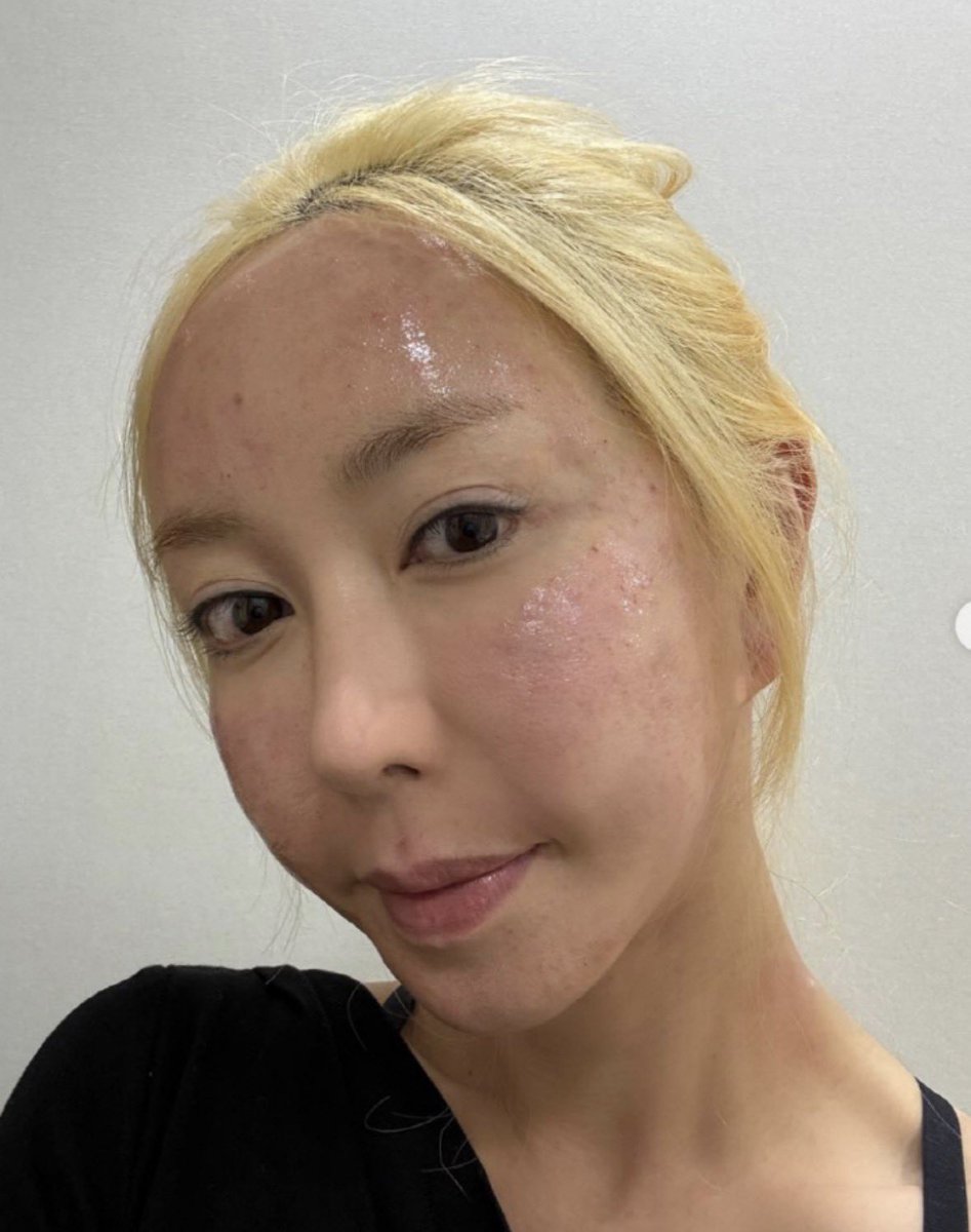 이지킬 tweet media