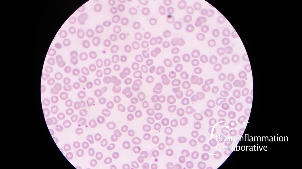 Brain Inflammation Collaborative tweet media