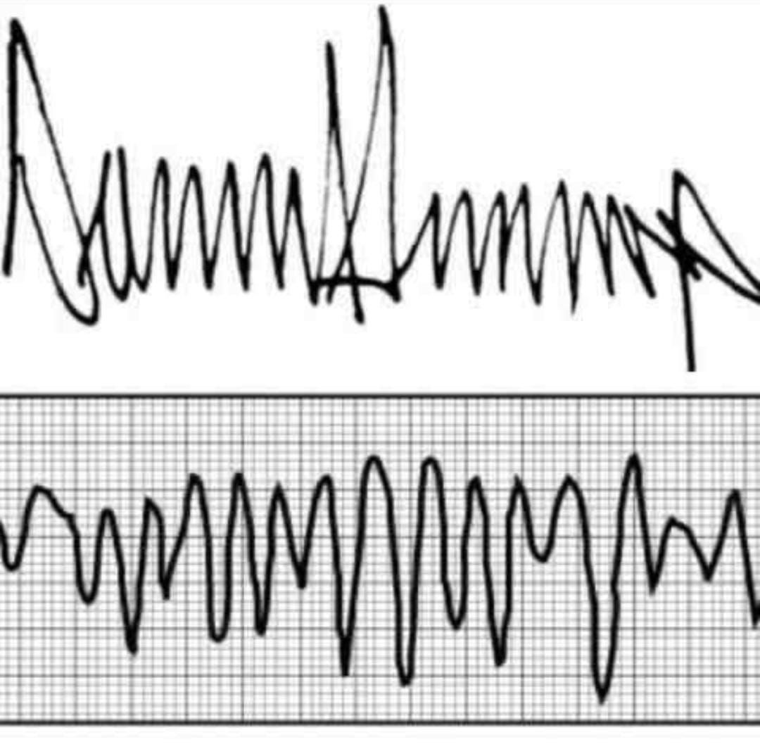 Novice2NSE tweet media