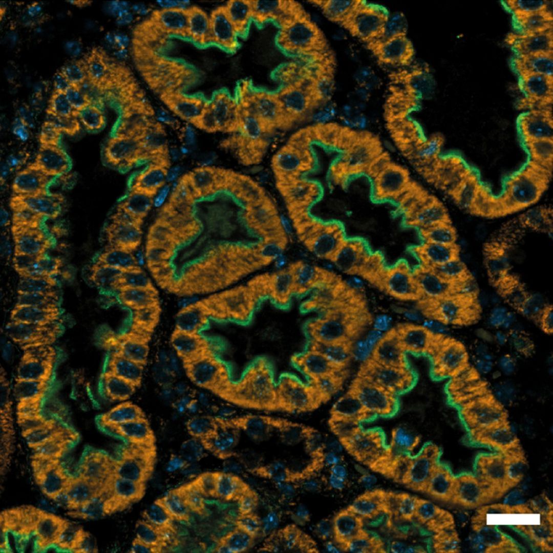 JCI insight tweet media