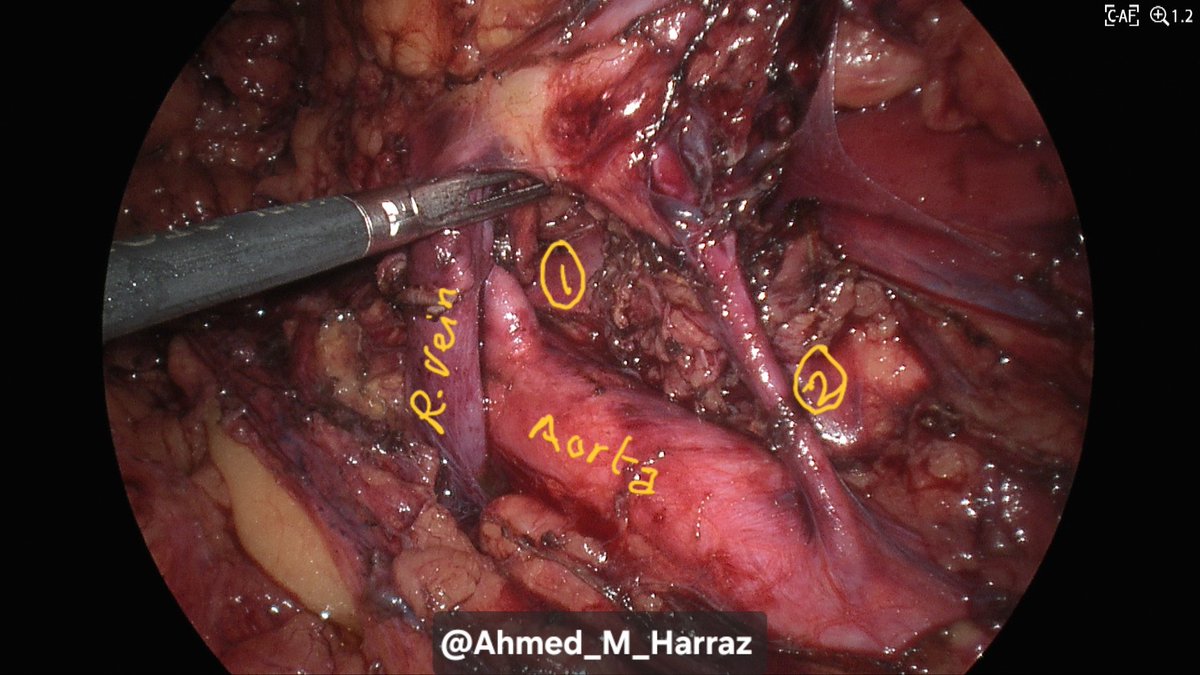 Ahmed M. Harraz tweet media