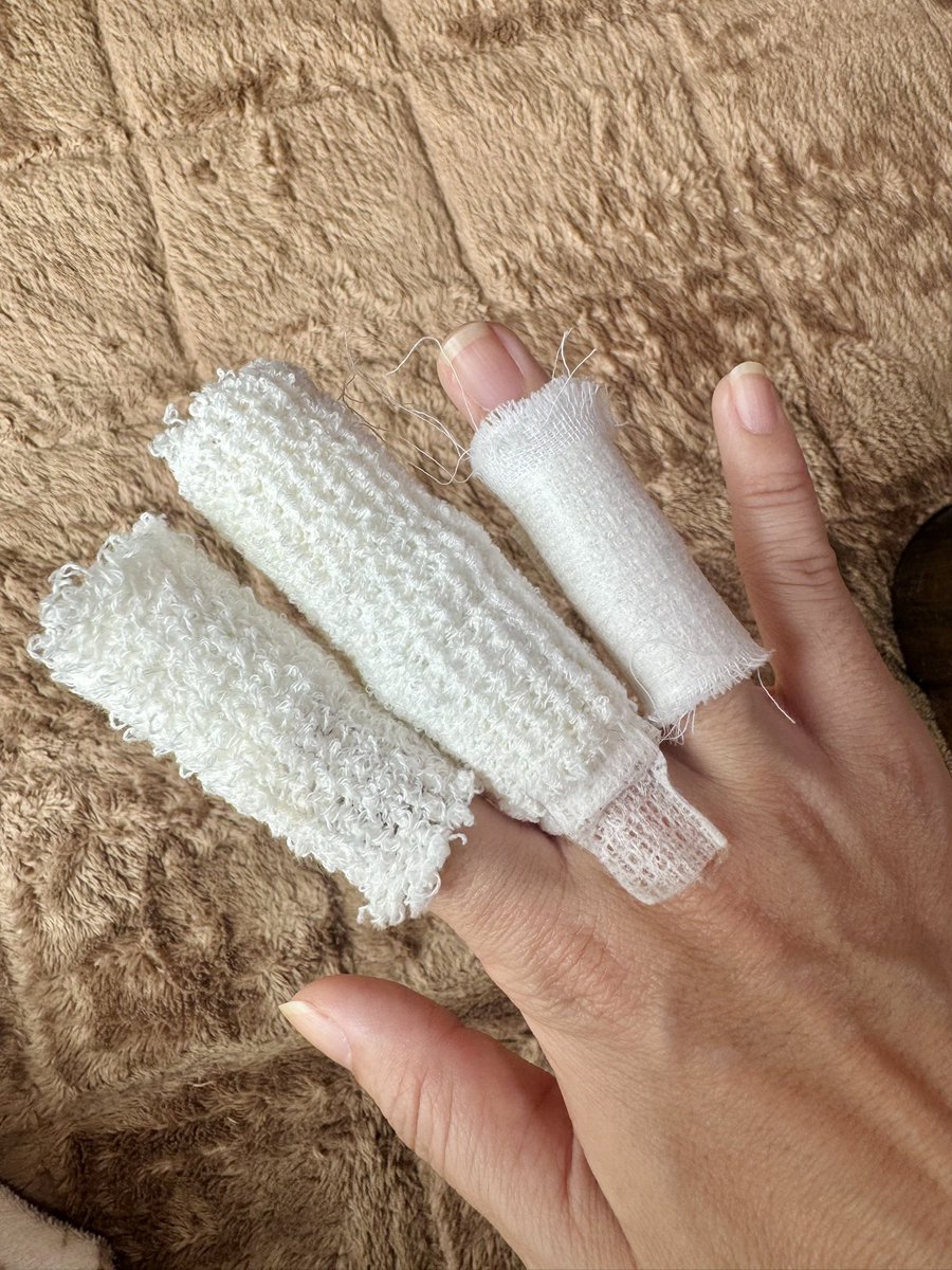 一番ひどいのは中指なんだけど、
軽い火傷のところも軟膏塗ってガーゼ貼ってるから、見た目大惨事😇