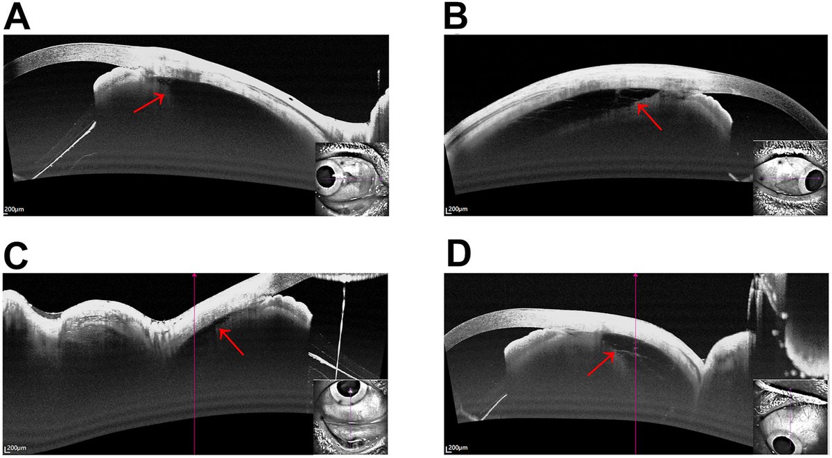 Ophthalmology tweet media
