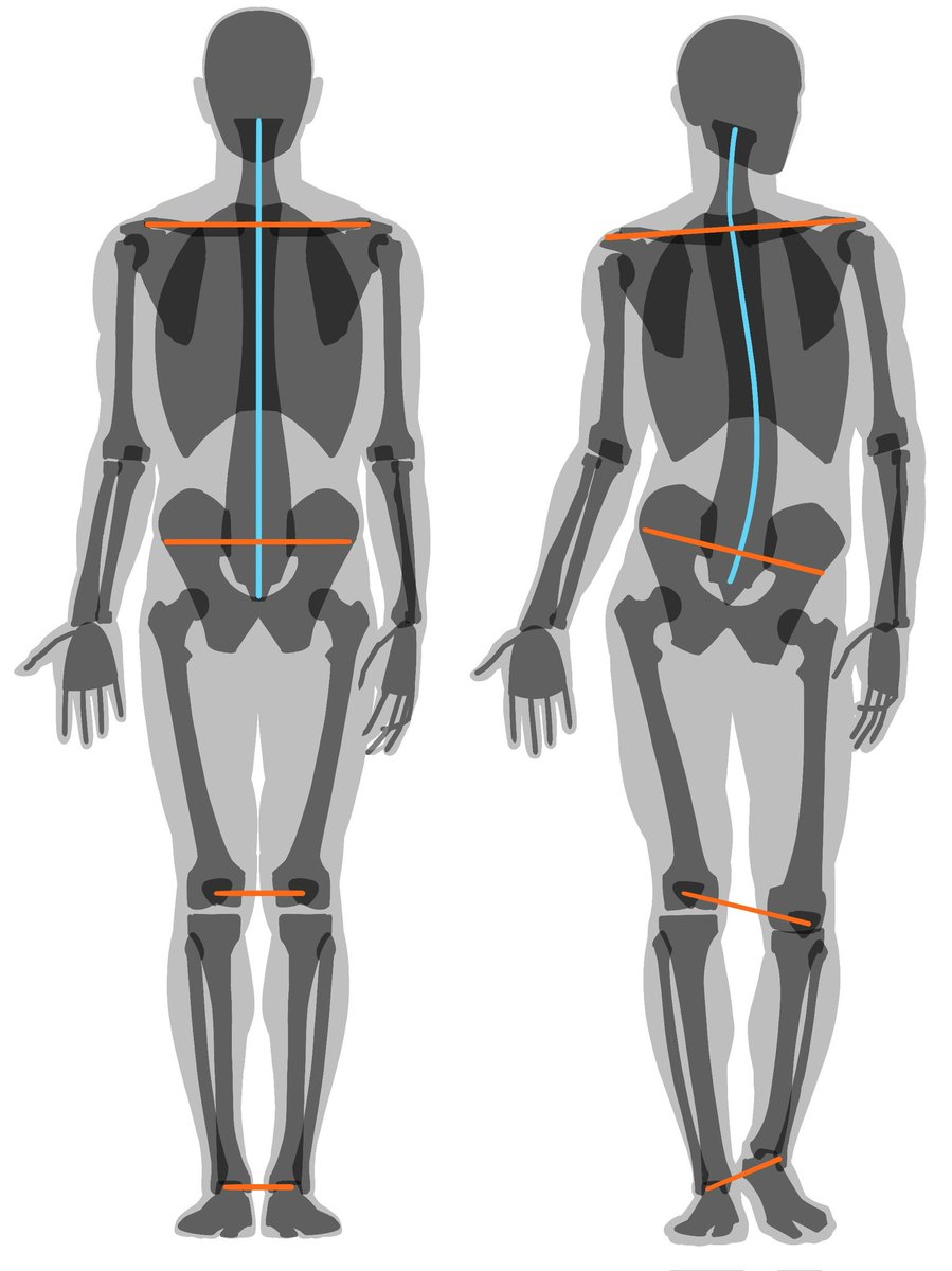 コントラポスト（片足重心）では背骨も左右に傾きます