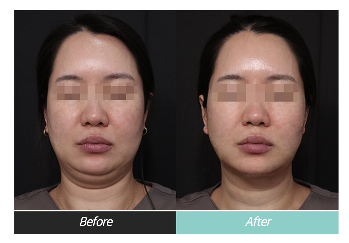 【公式】リバースクリニック | 江南・明洞・弘大 tweet media