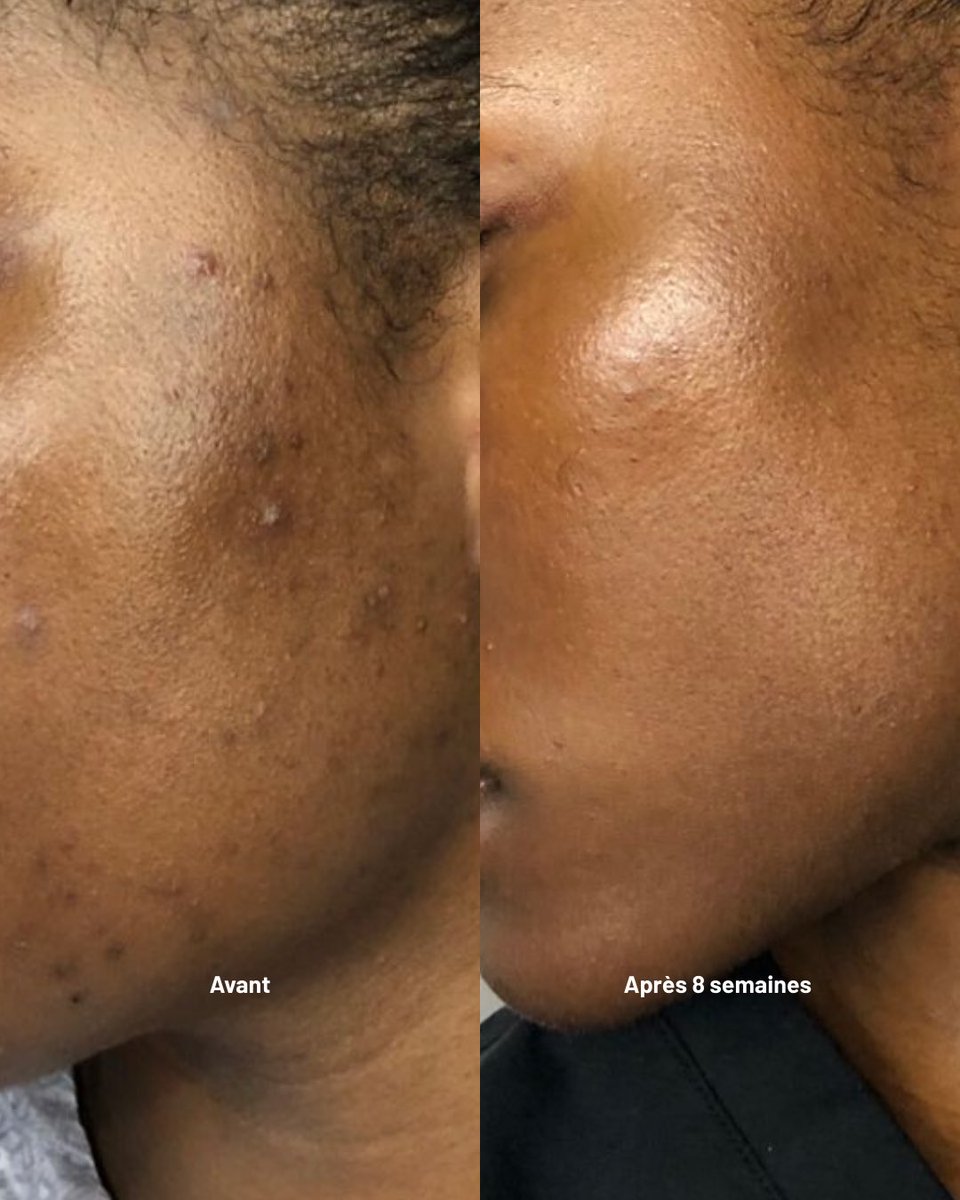 Millena 🇨🇲 🇪🇸 tweet media