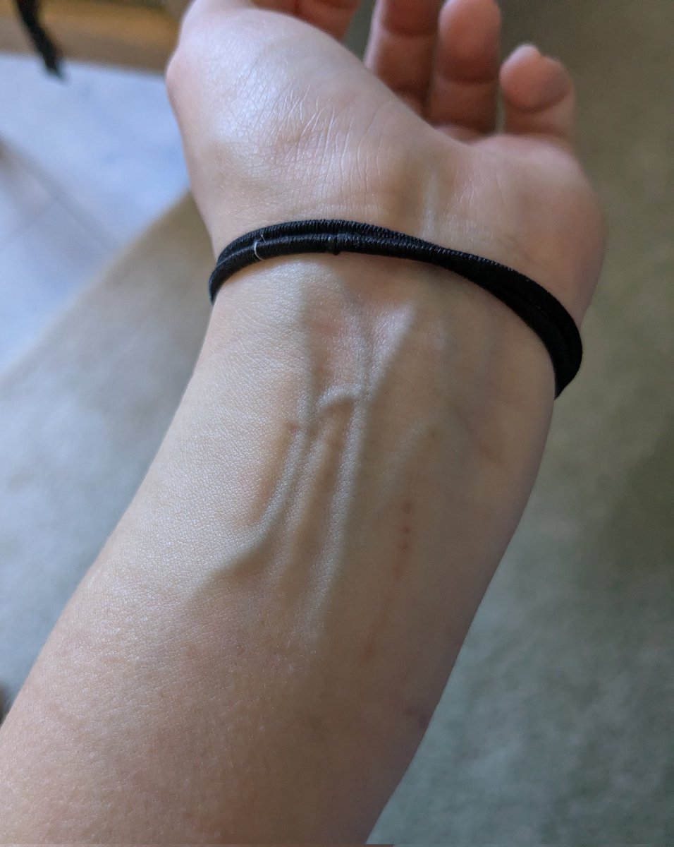 Yuria of Ailurus 🎋 @ BACK HORT RECOVERY ARC tweet media