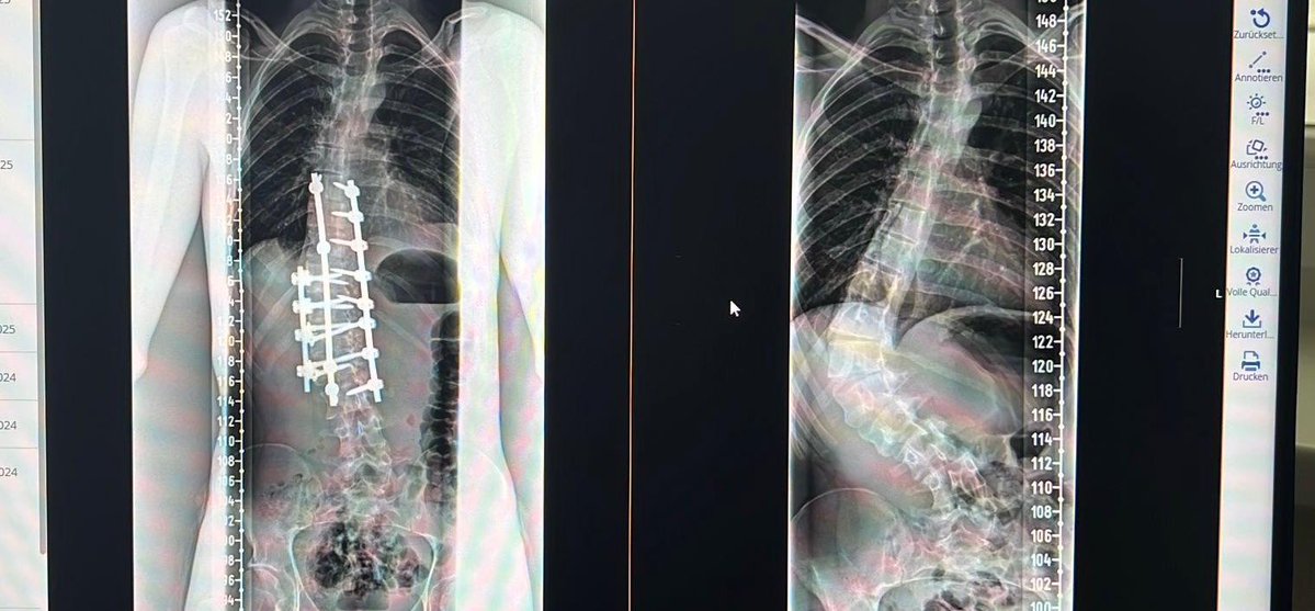 Babo Finn Prime tweet media