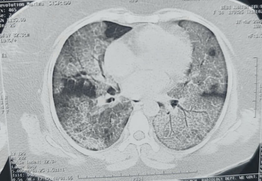 Arghya Bandyopadhyay tweet media