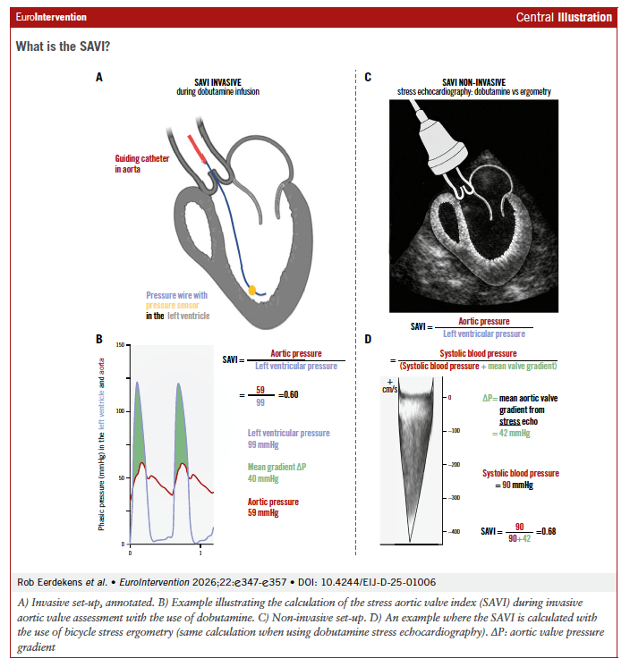 EuroIntervention tweet media