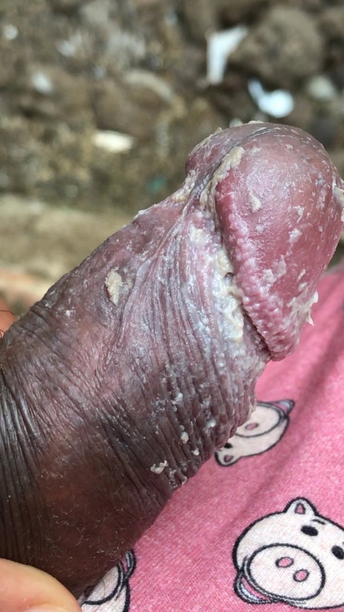 Picapreta tweet media