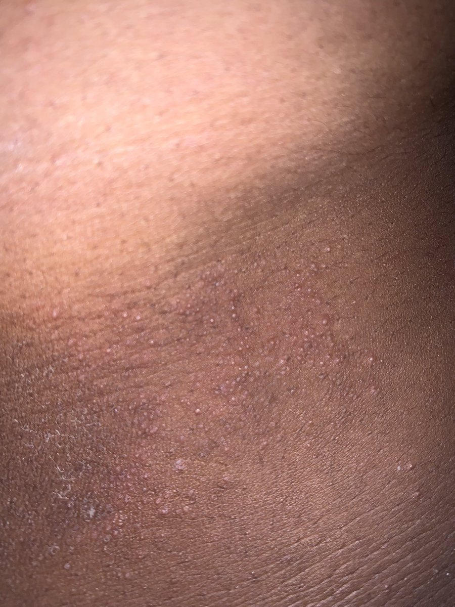 Jane🌸 tweet media