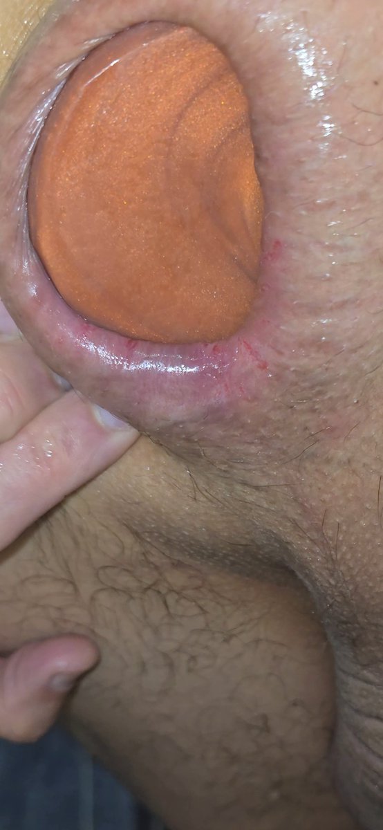 anallover25(+18) 🇨🇵🇨🇦 tweet media