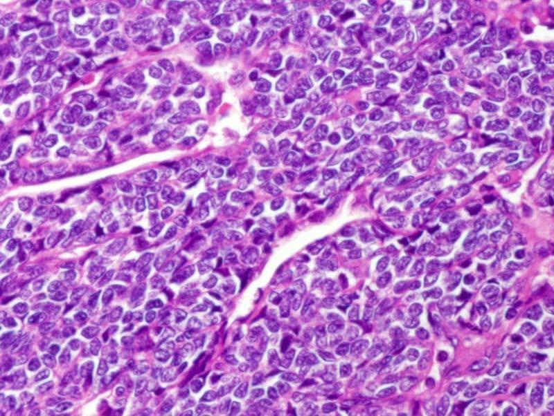 Charlie Herndon tweet media