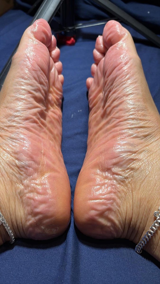 SNothings202's tweet photo. Question for my feet lovers…… what do you like most toes or soles? #latinafeet #meatysoles #whitetoes #prettytoes #prettysoles https://t.co/q0yOb8AuZp