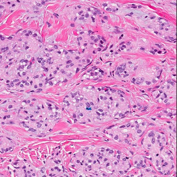 Charlie Herndon tweet media