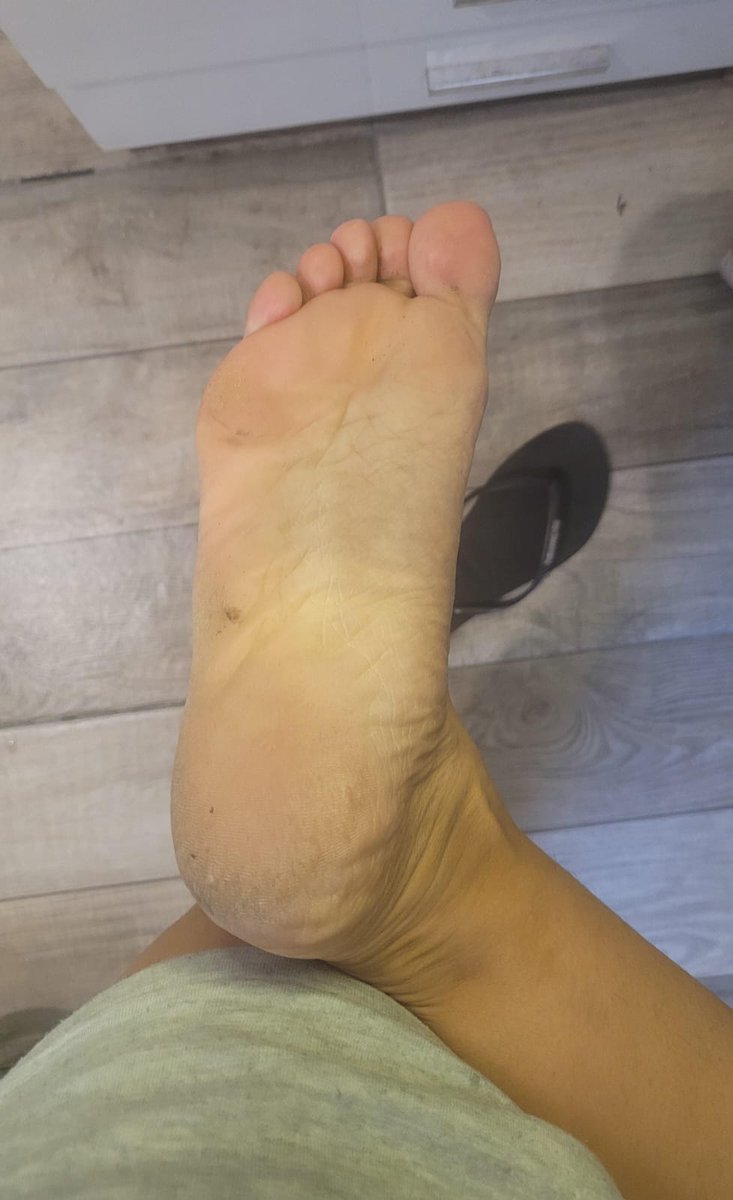 MySolesOF's tweet photo. Dry heels &amp; natural texture… anyone into this? https://t.co/ijFri8V5EC
