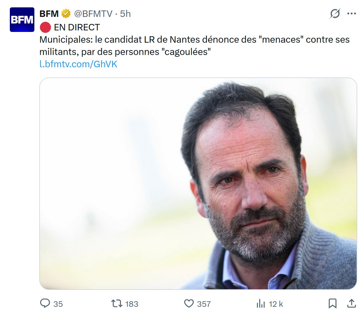 Contre Attaque tweet media