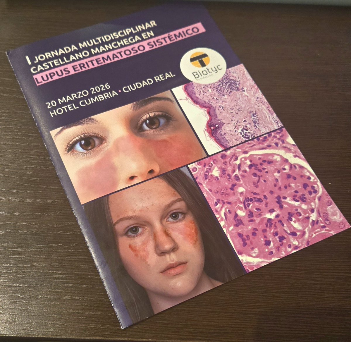 MarcoReudol's tweet photo. Espectacular iniciativa que reúne a diversos especialistas en el entendimiento y manejo de las enfermedades inmunomediadas en Castilla la Mancha, a por muchas más....
#sescam
#rheumatology 
#autoinmunedisease https://t.co/V5rSgziuNf