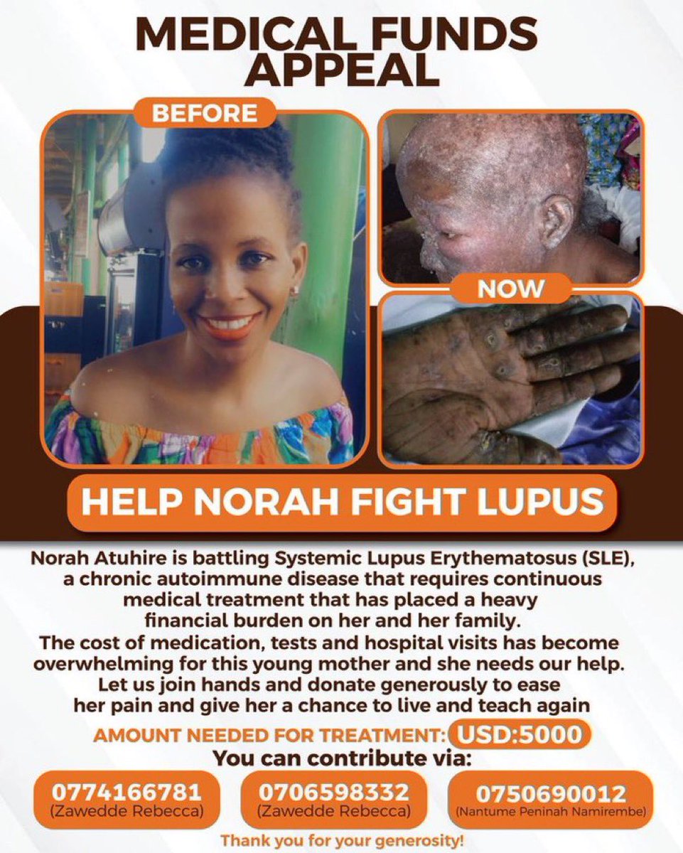 Emma 🇺🇬™ tweet media