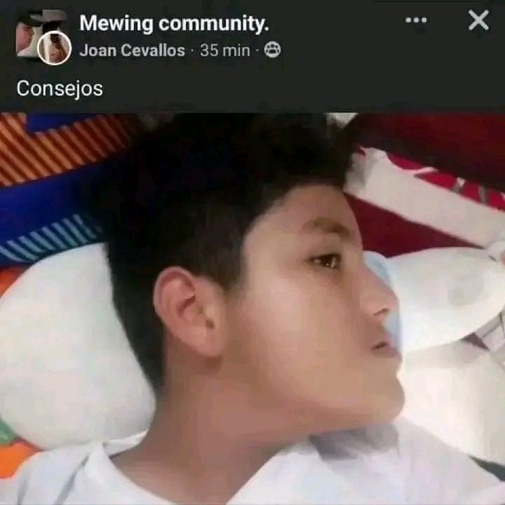 Snor 🐢 tweet media