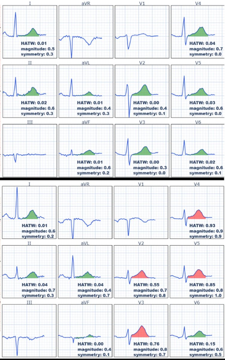 Brooks Walsh tweet media